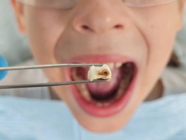 Best Pediatric Emergency Dentist in Colonial Rk, PA